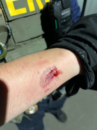 Brendan John Geier, 26, of Madison, New Jersey engaged in a struggle with deportation officers, kicking  and ultimately biting one officer’s forearm, and another’s knuckle.